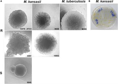 A Murine Model of Mycobacterium kansasii Infection Reproducing Necrotic Lung Pathology Reveals Considerable Heterogeneity in Virulence of Clinical Isolates